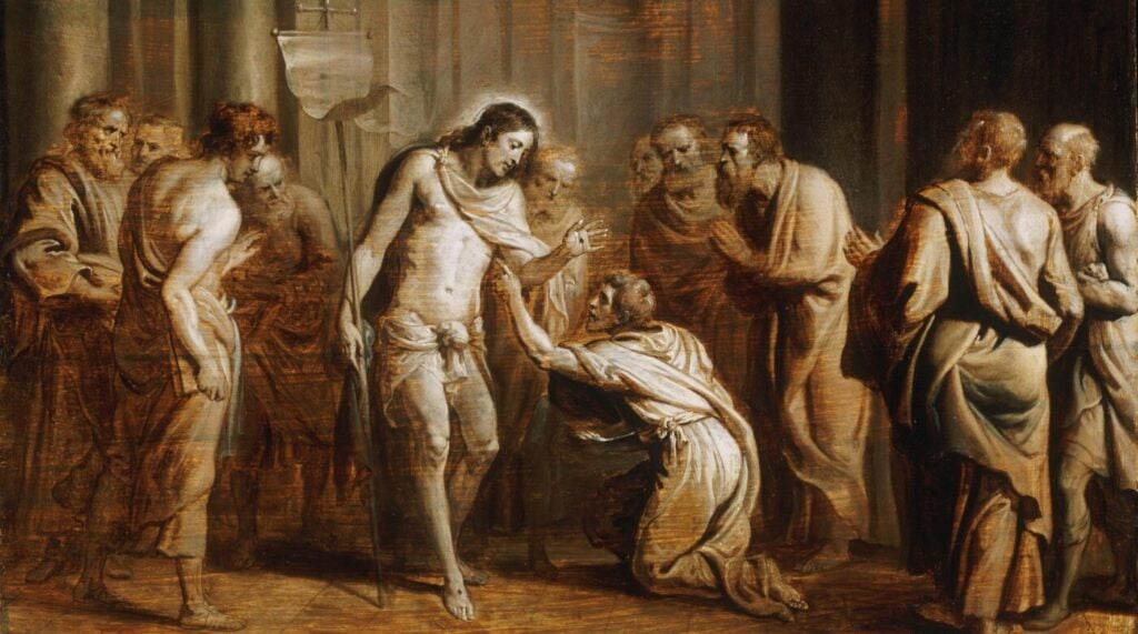 Why Jesus Retained His Crucifixion Wounds and What They Mean for Us